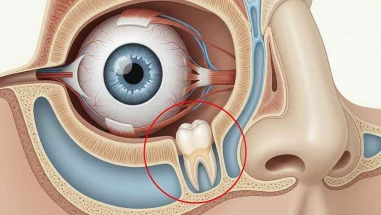 Medical miracle, teeth growing in the eye